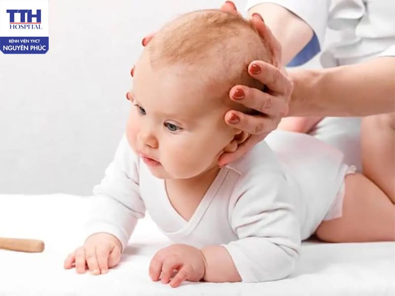 Bại não là một tình trạng rối loạn vận động do tổn thương não bộ trong quá trình phát triển