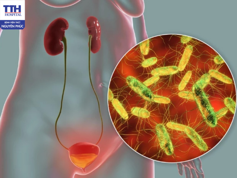 Các dấu hiệu nhận biết của nhiễm trùng tiết niệu thường có thể quan sát được