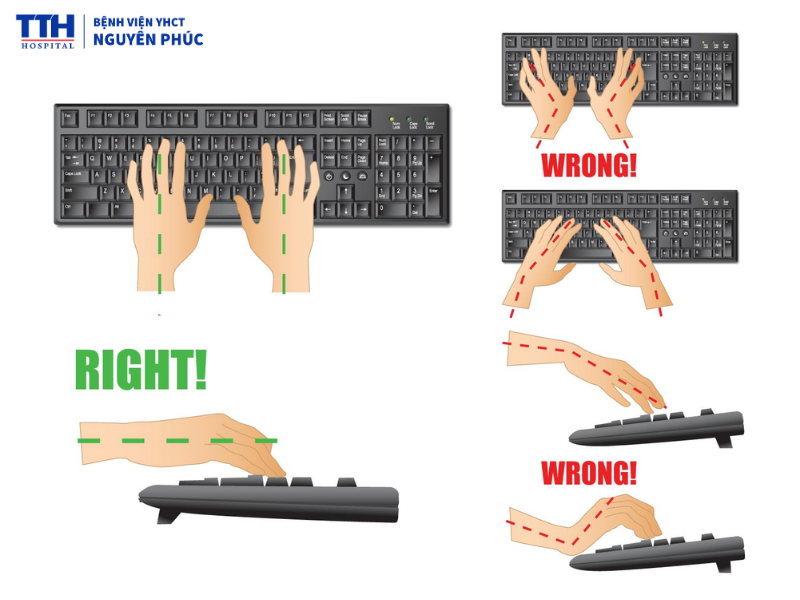 Cách phòng ngừa hội chứng ống cổ tay