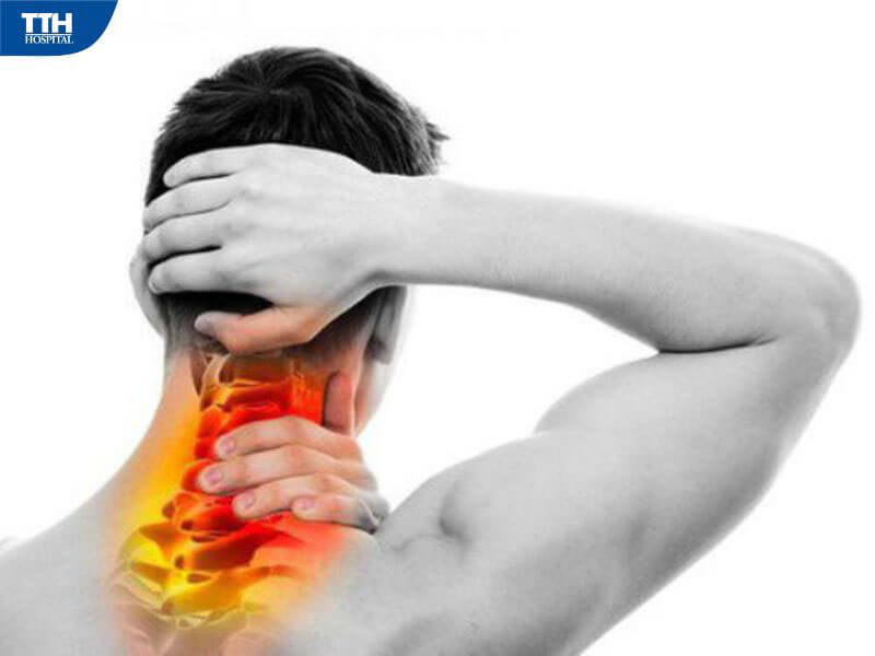 Đau vai gáy do căng cơ là gì?