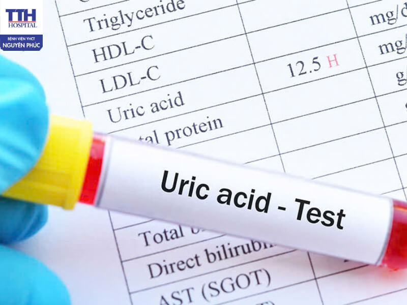 Giai đoạn 1: Gout chưa có triệu chứng (Tăng acid uric máu)