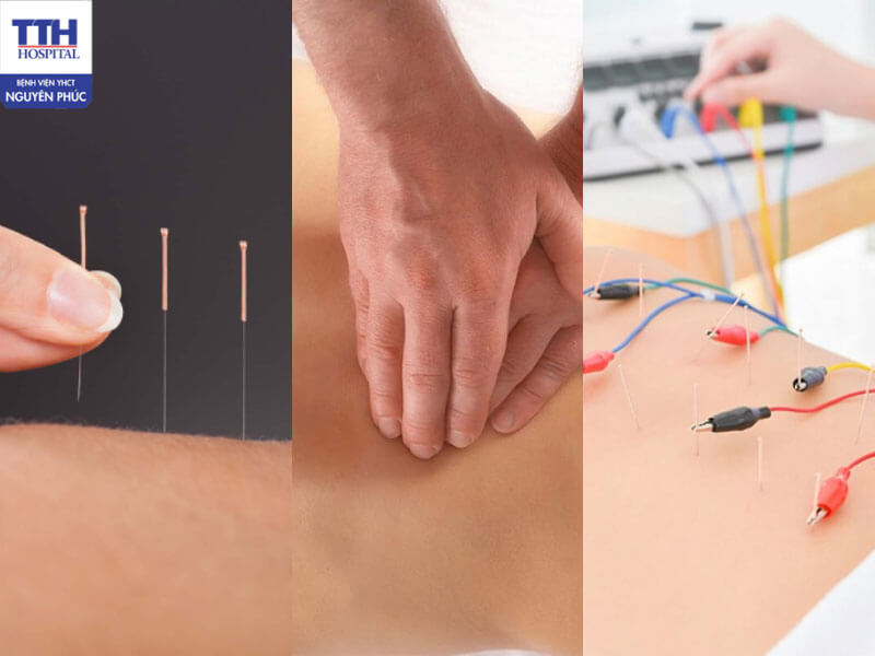 Giải pháp hỗ trợ điều trị thoát vị đĩa đệm theo Y học cổ truyền