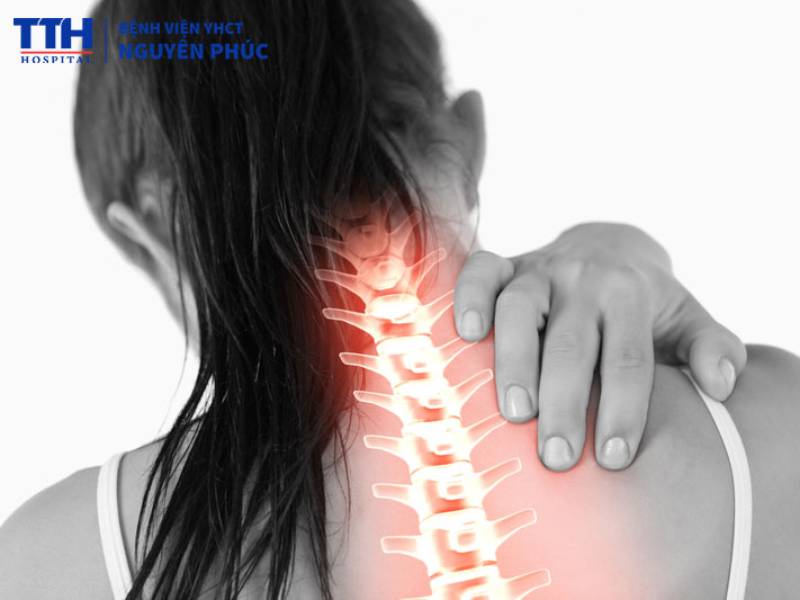Hội chứng cổ vai cánh tay là gì?