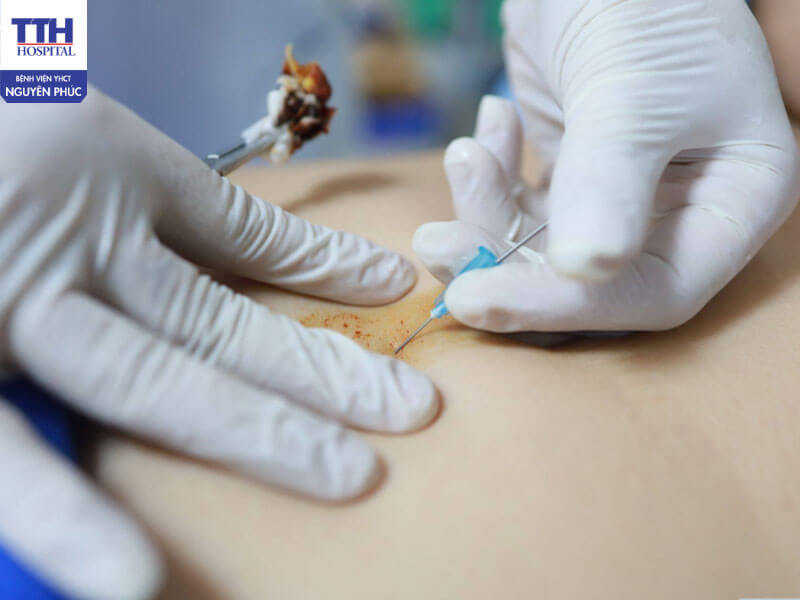 Khi nào cần đi khám bác sĩ?