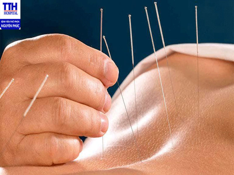 Liệu pháp Đông y hỗ trợ tăng đề kháng