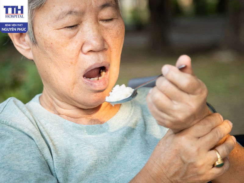 Lưu ý khi cho bệnh nhân đột quỵ ăn uống