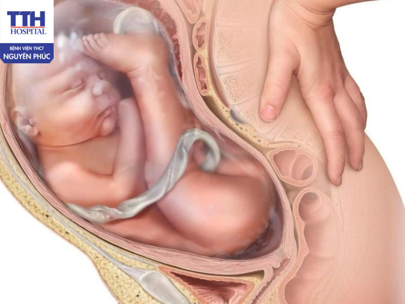 Nguyên nhân thường gặp