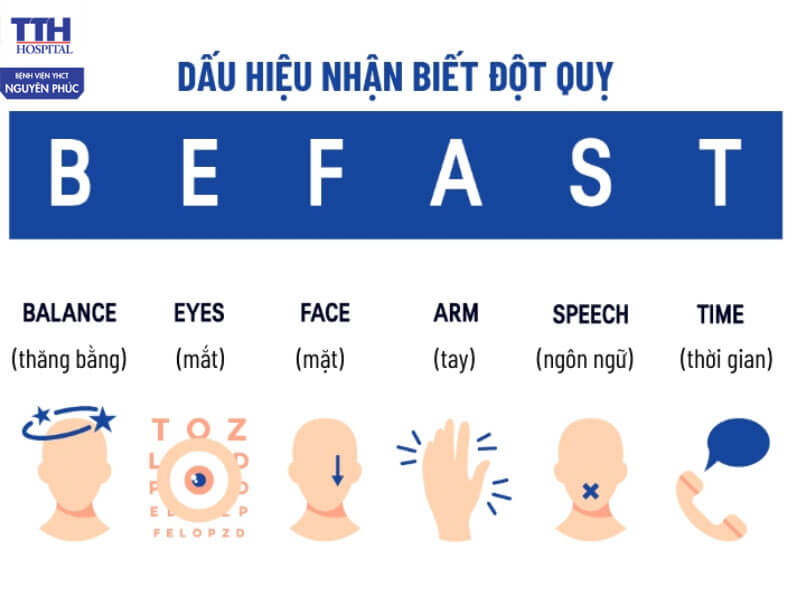 Nguyên tắc B.E.F.A.S.T cảnh báo dấu hiệu đột quỵ