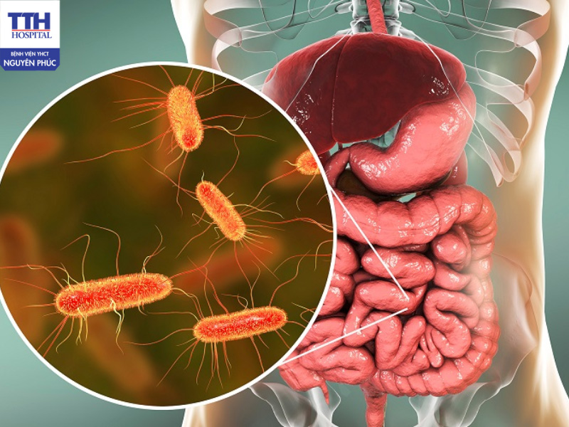 Nhiễm trùng tiết niệu là tình trạng vi khuẩn xâm nhập vào hệ tiết niệu