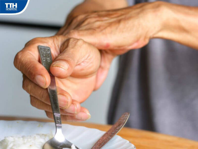 Những biểu hiện ban đầu của bệnh Parkinson