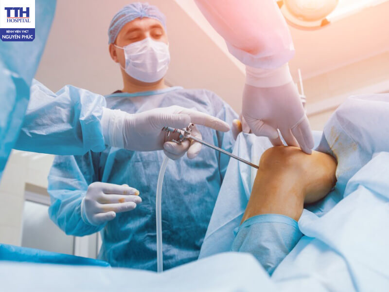 Phẫu thuật tái tạo dây chằng giúp khôi phục lại tính ổn định của khớp gối