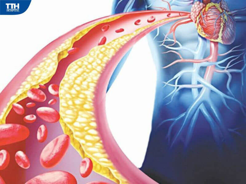 Phòng ngừa và kiểm soát bệnh hiệu quả