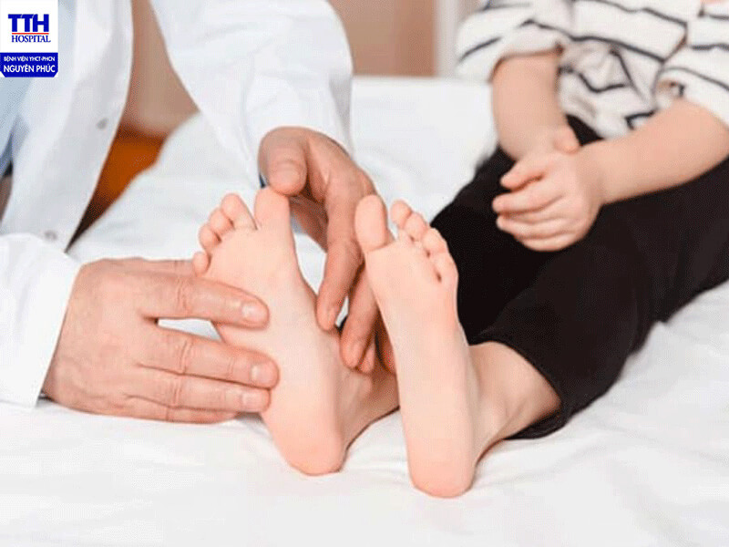 PHỤC HỒI BÀN CHÂN BẸT TẠI BV YHCT NGUYÊN PHÚC