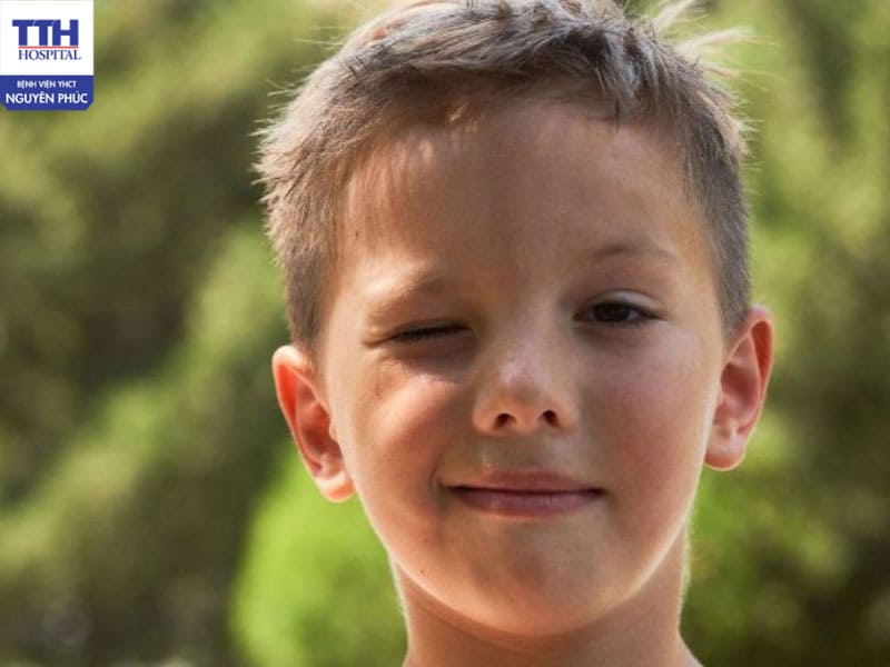 Rối loạn TIC – Hành vi không kiểm soát do rối loạn thần kinh