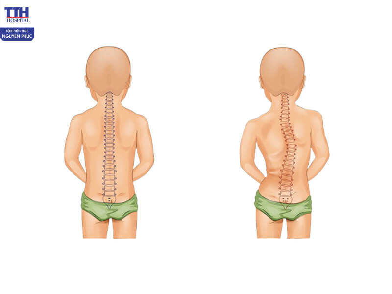 Tác hại nếu không phát hiện và điều trị sớm