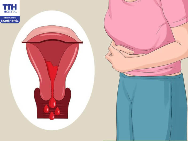 Thăm khám và điều trị bệnh rối loạn kinh nguyệt sớm để tránh ảnh hưởng đến sinh sản