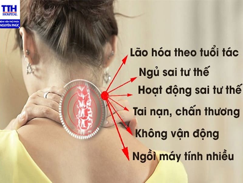 Thoát Vị Đĩa Đệm Cổ C5-C6 – Nguyên Nhân Không Thể Bỏ Qua