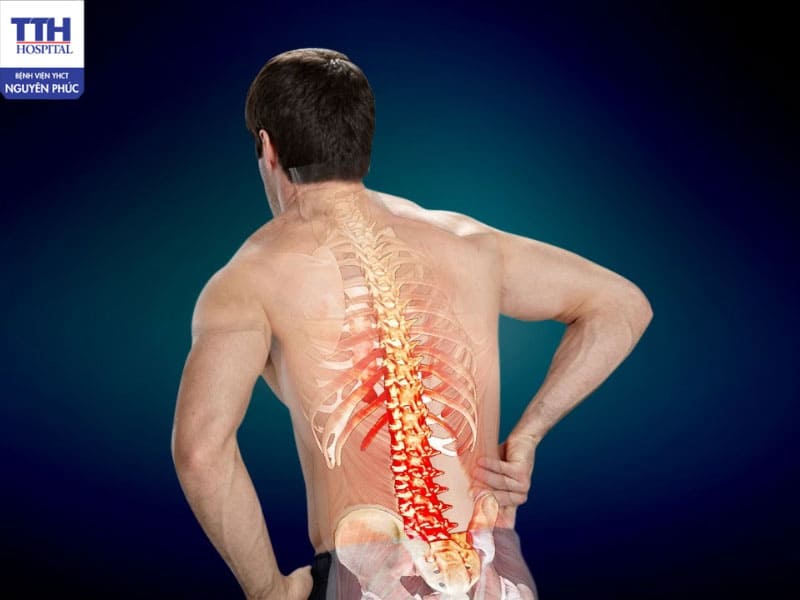 Thoát vị đĩa đệm là một trong những bệnh lý cột sống phổ biến