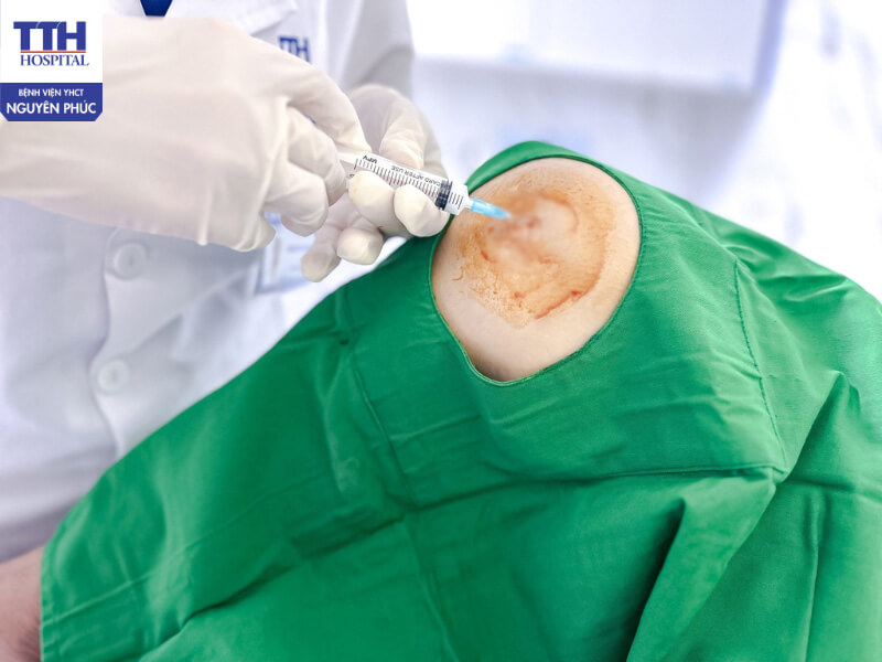 Tiêm nội khớp chất nhờn nhân tạo HA là gì?