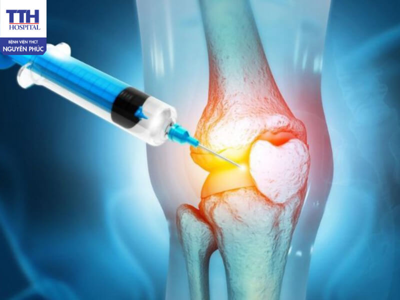 Tổng quan về chất nhờn HA trong khớp gối