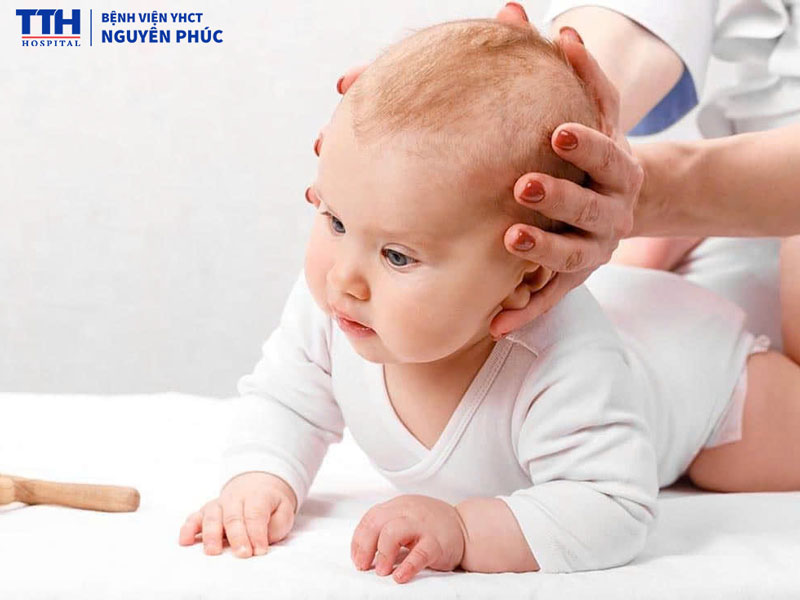 Trẻ bị vẹo cổ vì sao cần điều trị sớm?