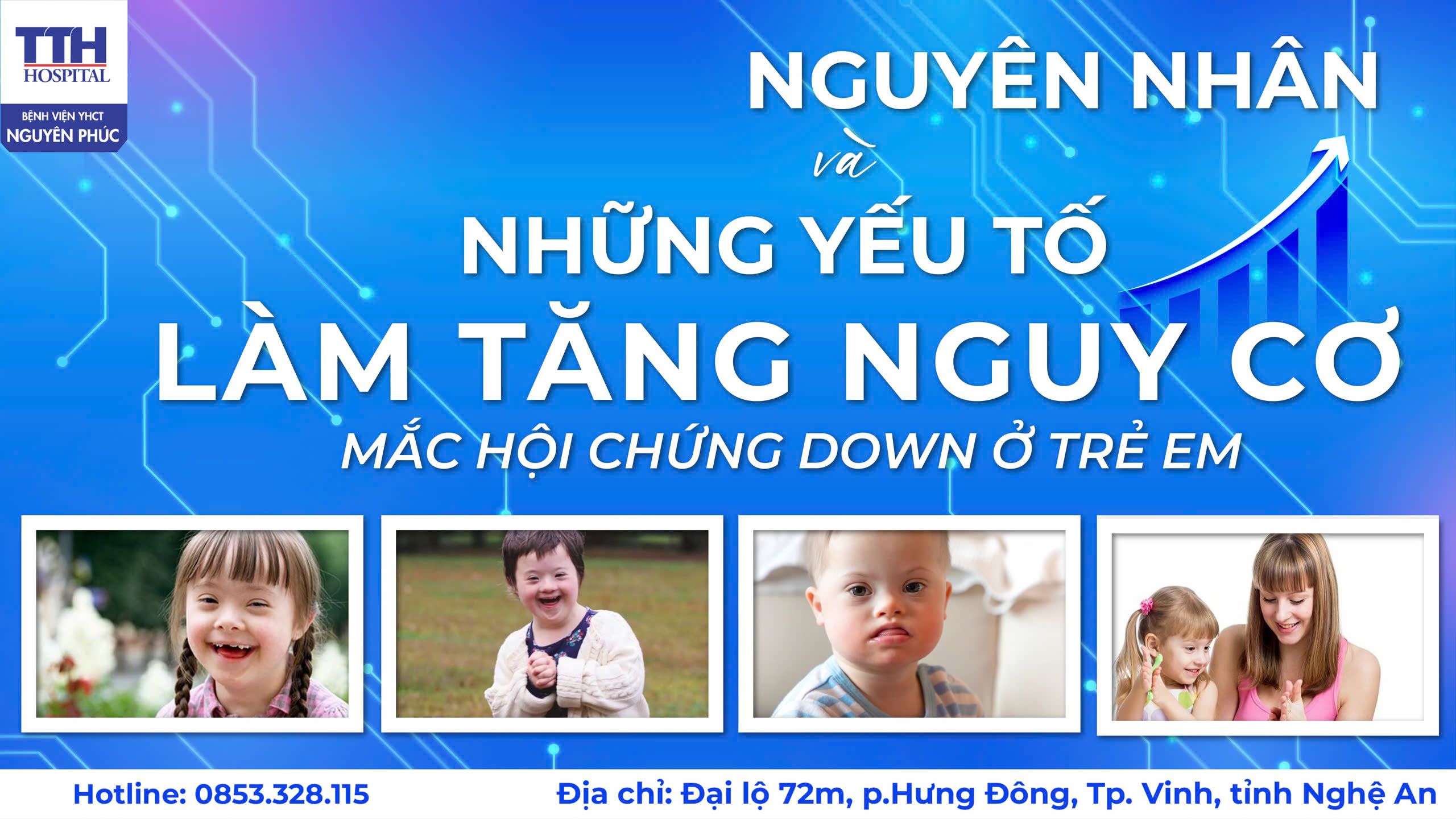 NGUYÊN NHÂN VÀ NHỮNG YẾU TỐ LÀM TĂNG NGUY CƠ MẮC HỘI CHỨNG DOWN Ở TRẺ