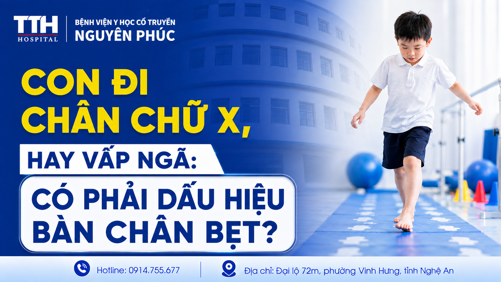 CON ĐI CHÂN CHỮ X, HAY VẤP NGÃ: CÓ PHẢI DẤU HIỆU BÀN CHÂN BẸT?