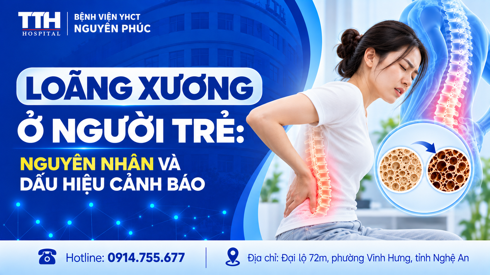 LOÃNG XƯƠNG Ở NGƯỜI TRẺ: NGUYÊN NHÂN VÀ DẤU HIỆU CẢNH BÁO