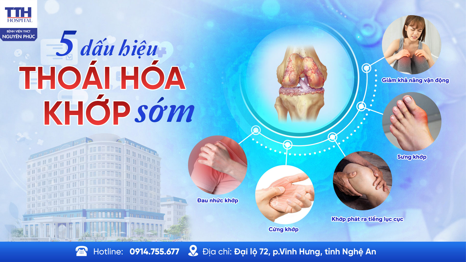 5 DẤU HIỆU THOÁI HÓA KHỚP SỚM