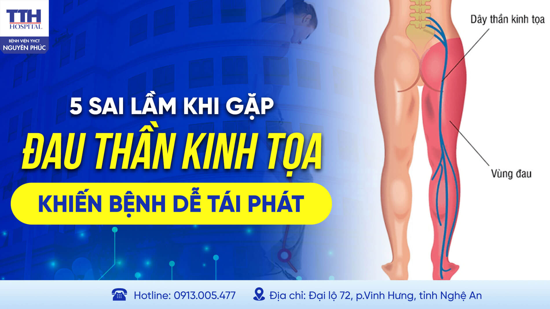 5 SAI LẦM KHI GẶP ĐAU THẦN KINH TỌA KHIẾN BỆNH DỄ TÁI PHÁT