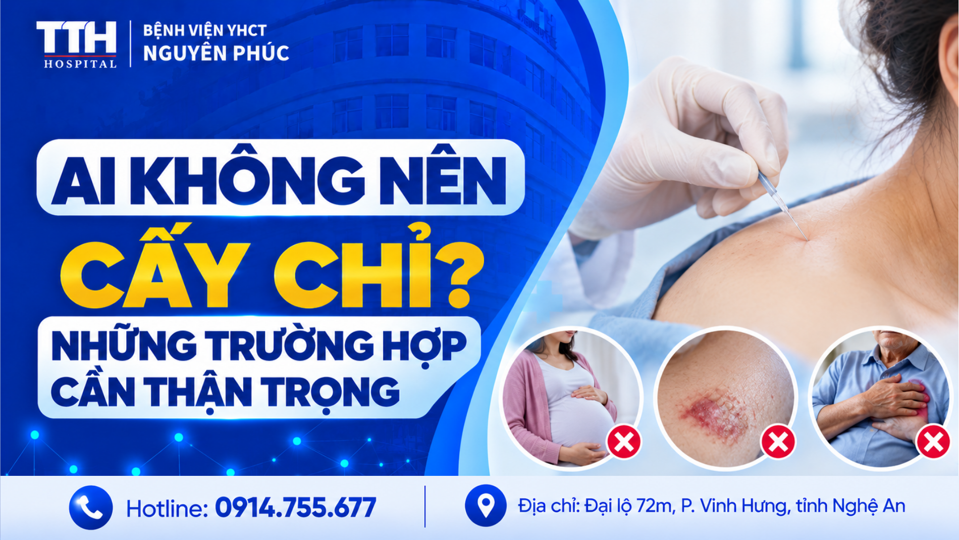 AI KHÔNG NÊN CẤY CHỈ? NHỮNG TRƯỜNG HỢP CẦN THẬN TRỌNG