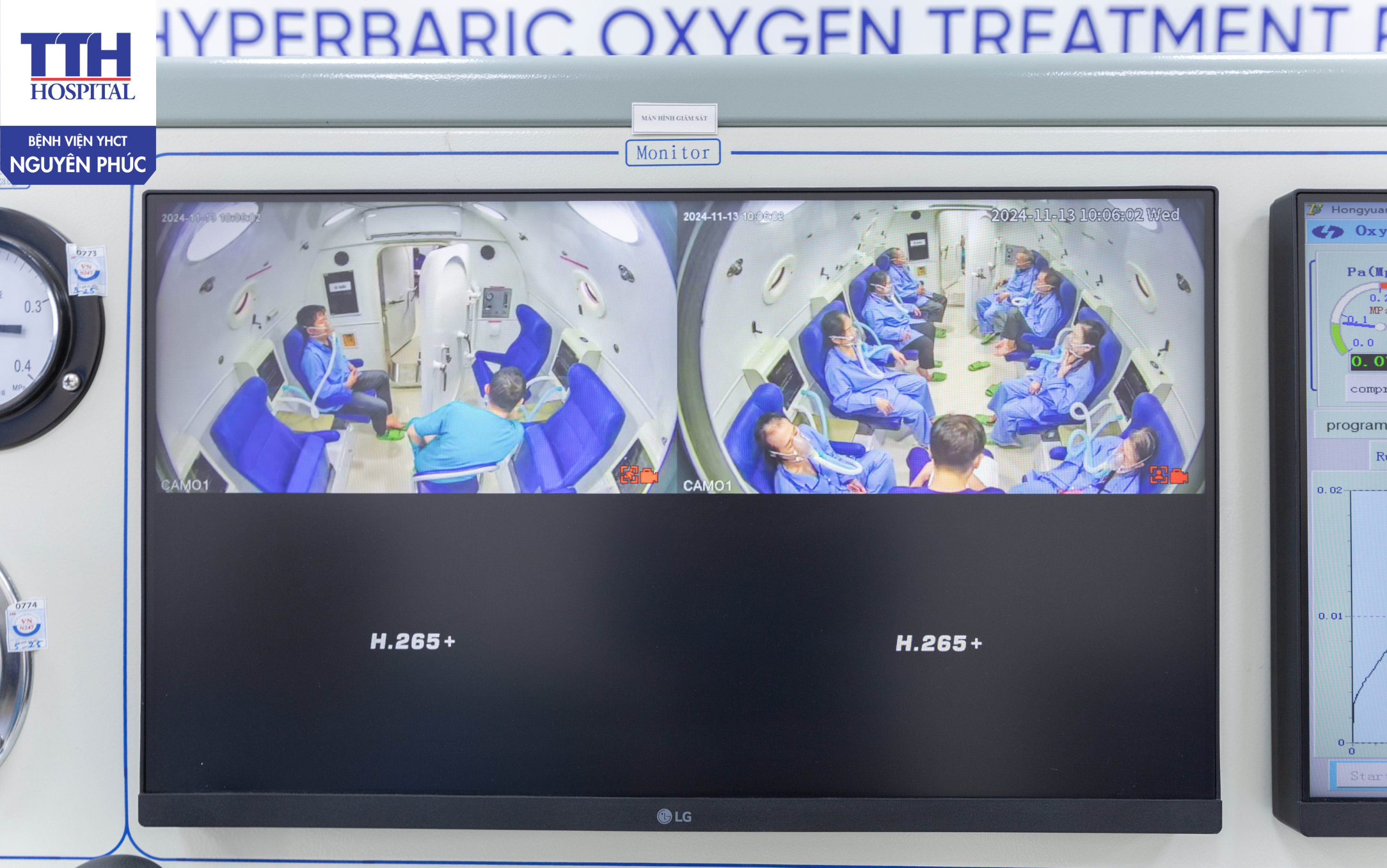 Điều trị Suy nhược cơ thể, stress do căng thẳng bằng hệ thống Oxy cao áp (Hyperbaric Oxygen Treatment Room) kết hợp YHCT