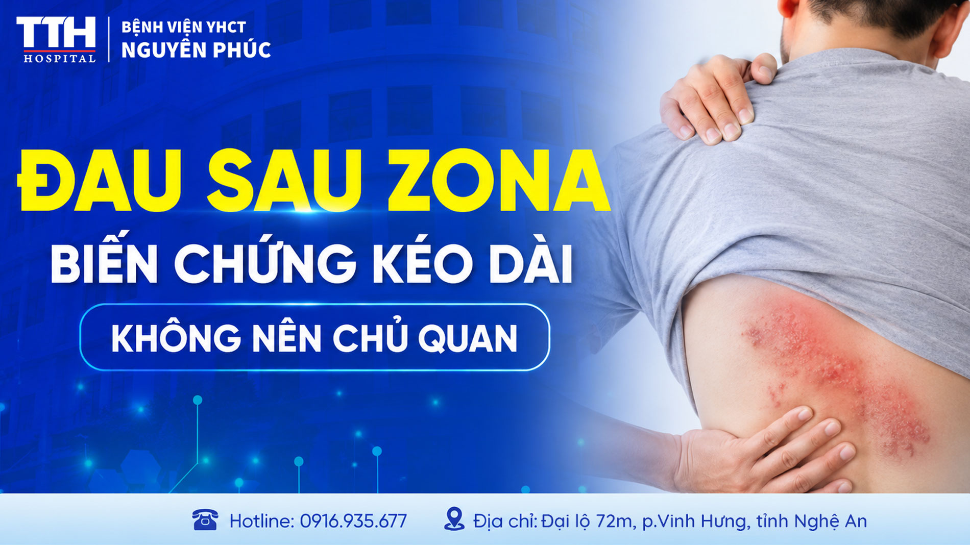ĐAU SAU ZONA - BIẾN CHỨNG KÉO DÀI KHÔNG NÊN CHỦ QUAN
