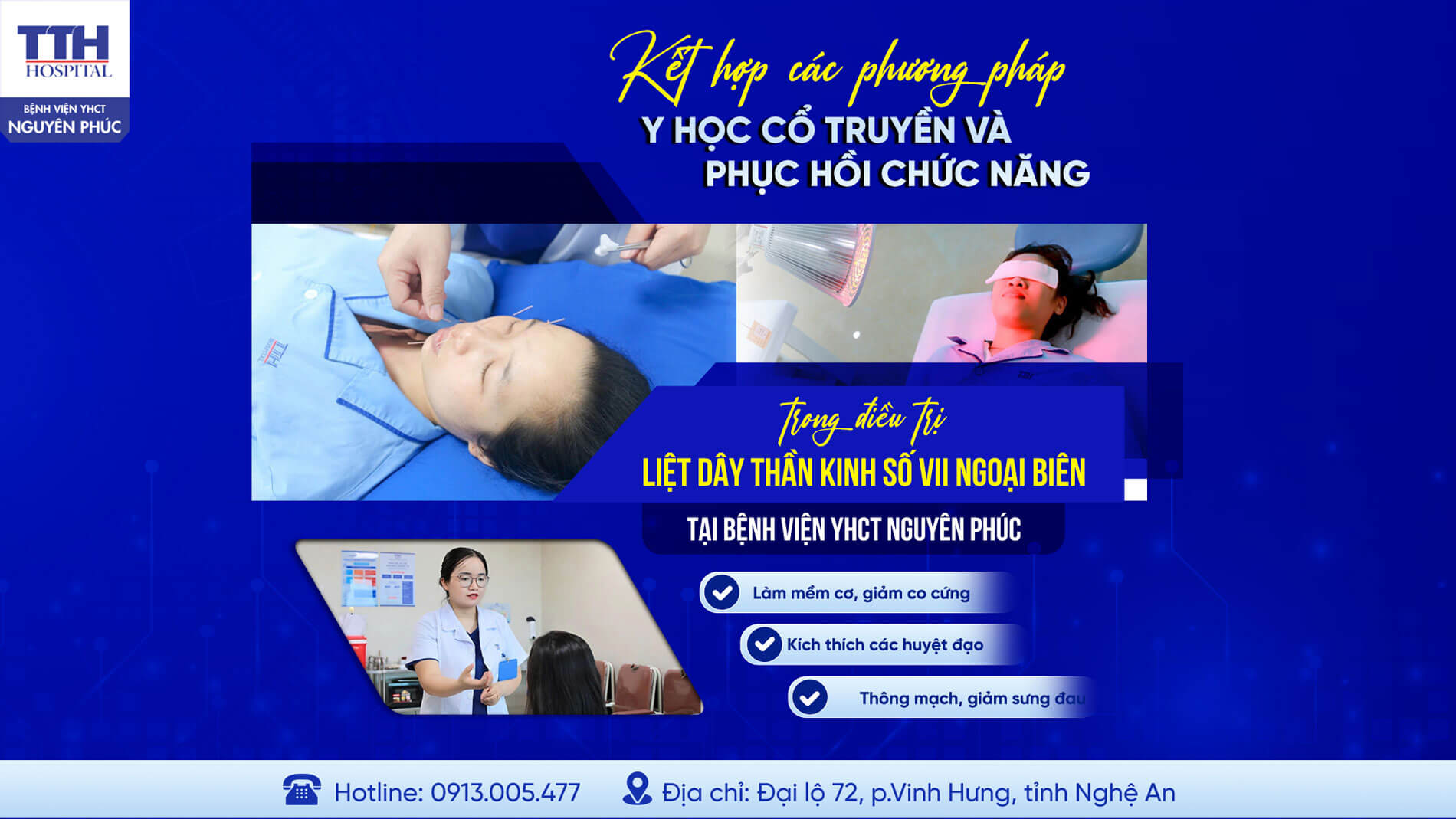 ĐIỀU TRỊ LIỆT DÂY THẦN KINH SỐ VII NGOẠI BIÊN