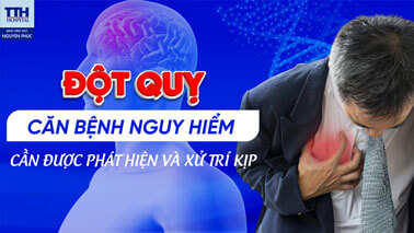 ĐỘT QUỴ – CĂN BỆNH NGUY HIỂM CẦN ĐƯỢC PHÁT HIỆN VÀ XỬ TRÍ KỊP THỜI