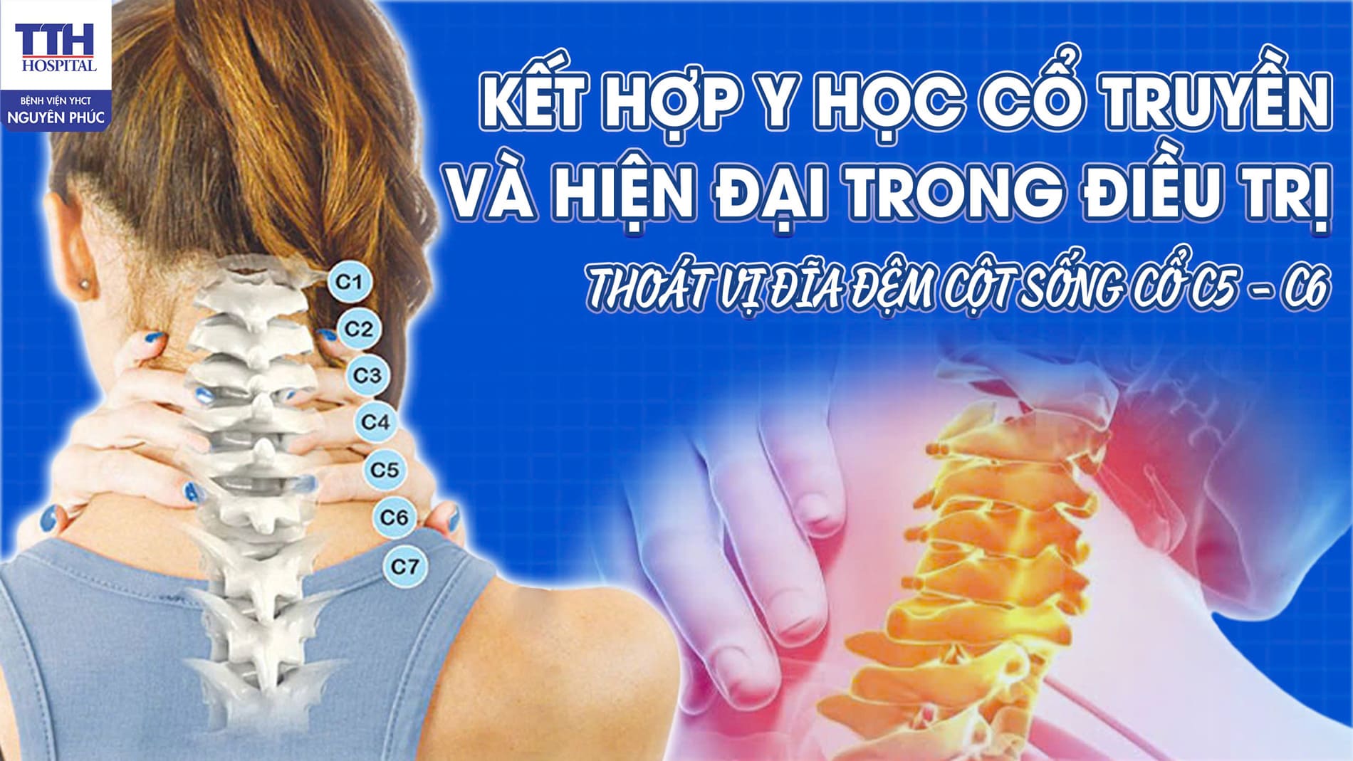 Kết Hợp Y Học Cổ Truyền Và Hiện Đại Trong Điều Trị Thoát Vị Đĩa Đệm Cột Sống Cổ C5-C6