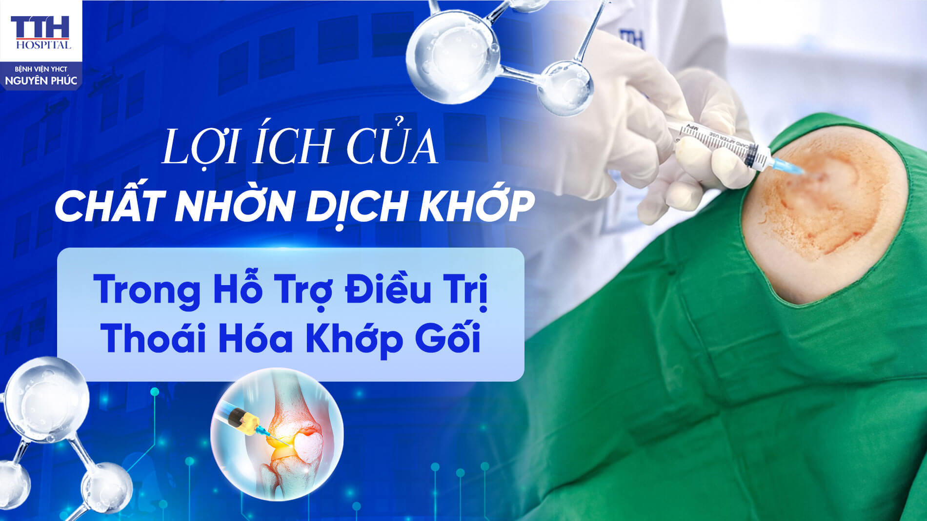 Lợi ích của tiêm chất nhờn dịch khớp trong hỗ trợ điều trị thoái hóa khớp gối