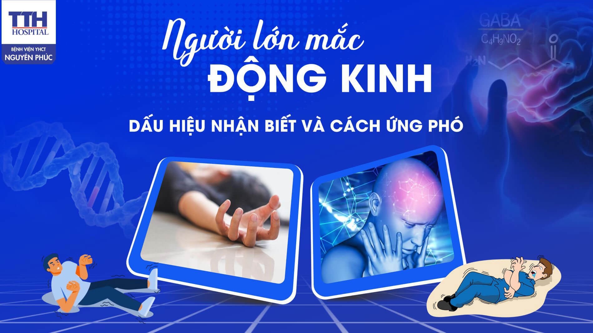 Người lớn mắc động kinh: Dấu hiệu nhận biết và cách ứng phó
