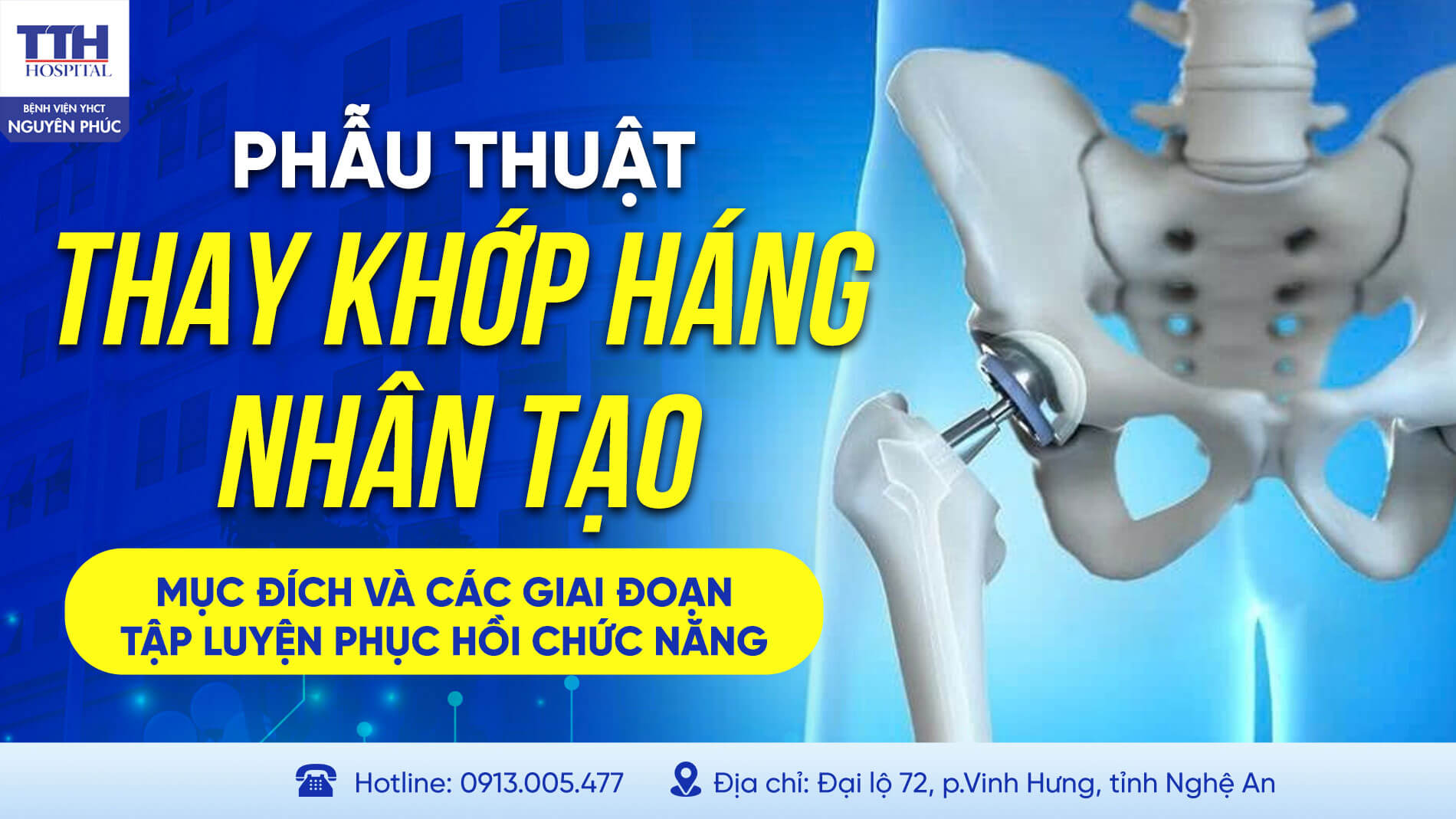 PHẪU THUẬT THAY KHỚP HÁNG NHÂN TẠO