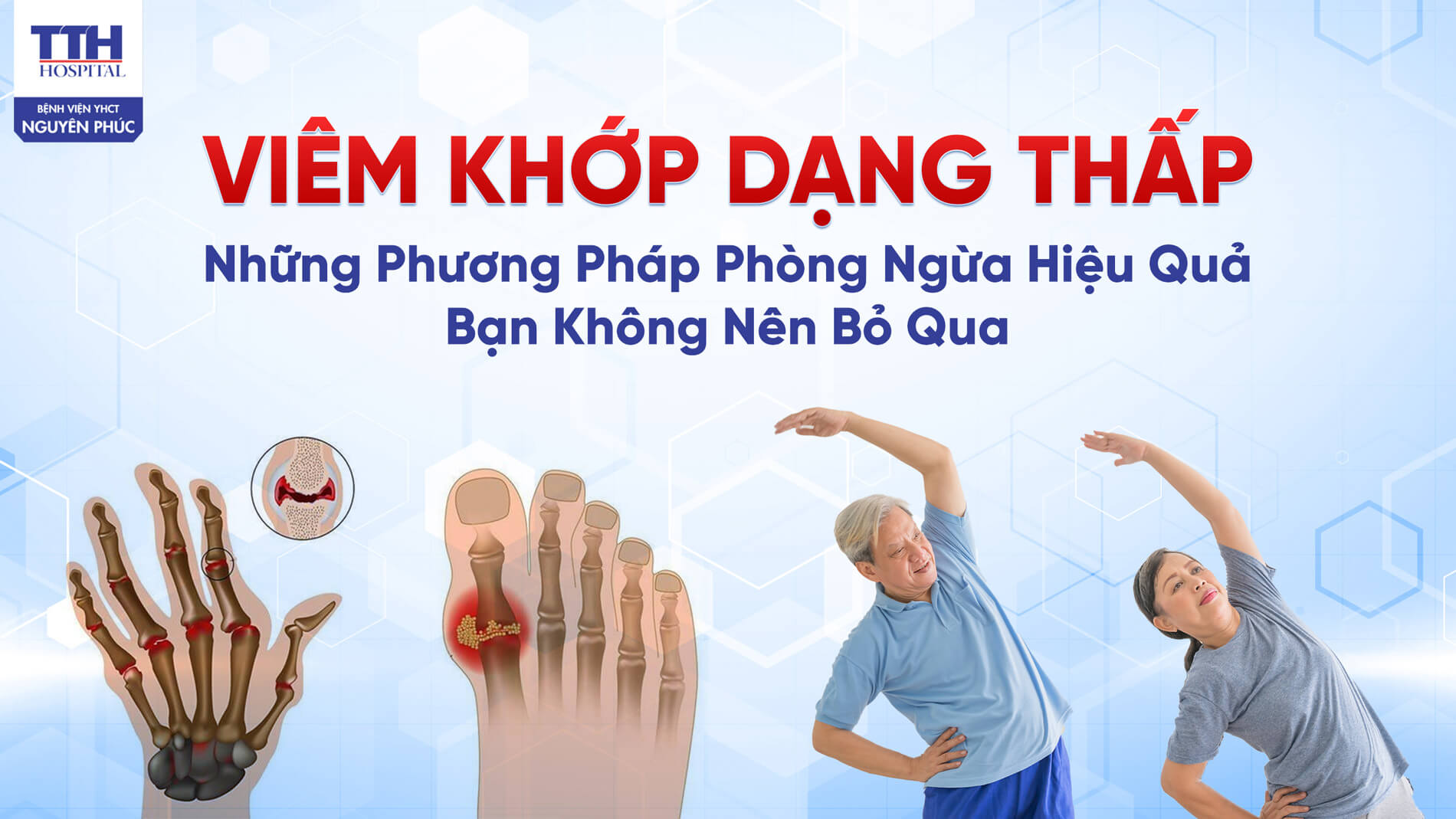Viêm khớp dạng thấp: những phương pháp phòng ngừa hiệu quả bạn không nên bỏ qua